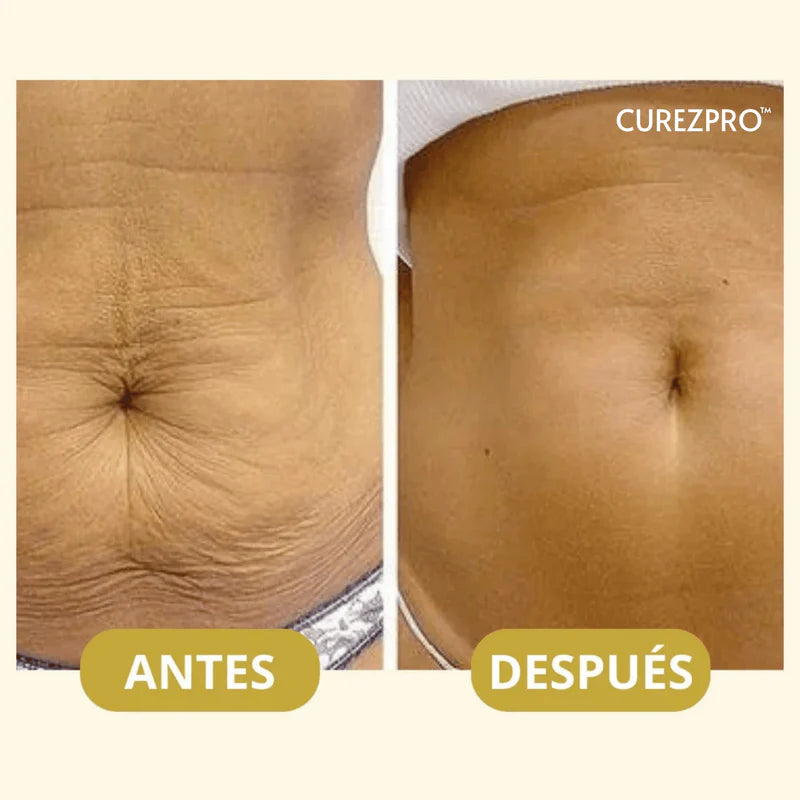 Aceite Corporal Original Magic™ - 100ml