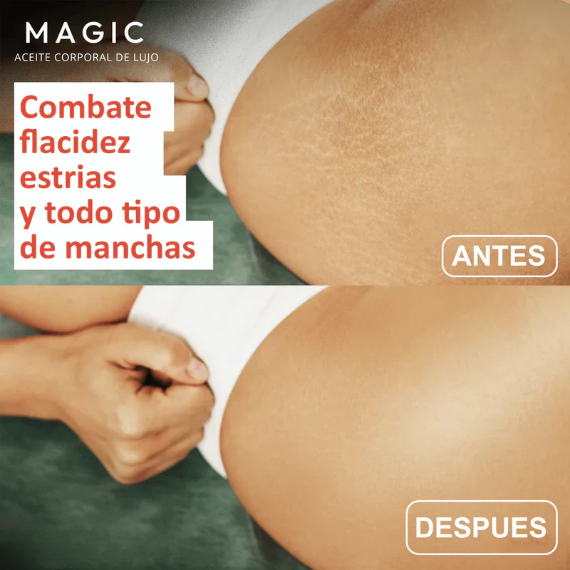 Aceite Corporal Original Magic™ - 100ml